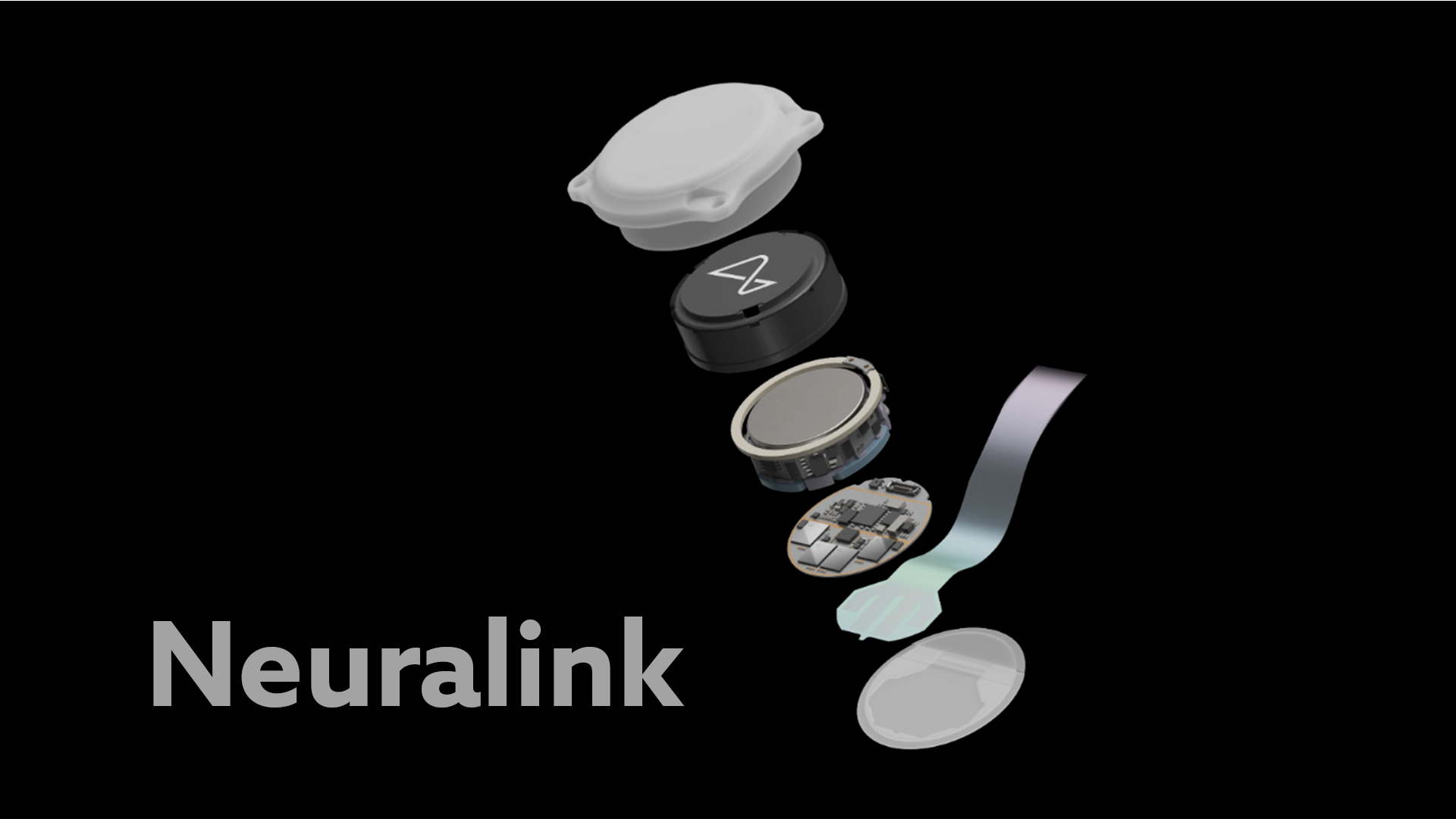 Neuralink: el tercer implante cerebral humano ya es una realidad